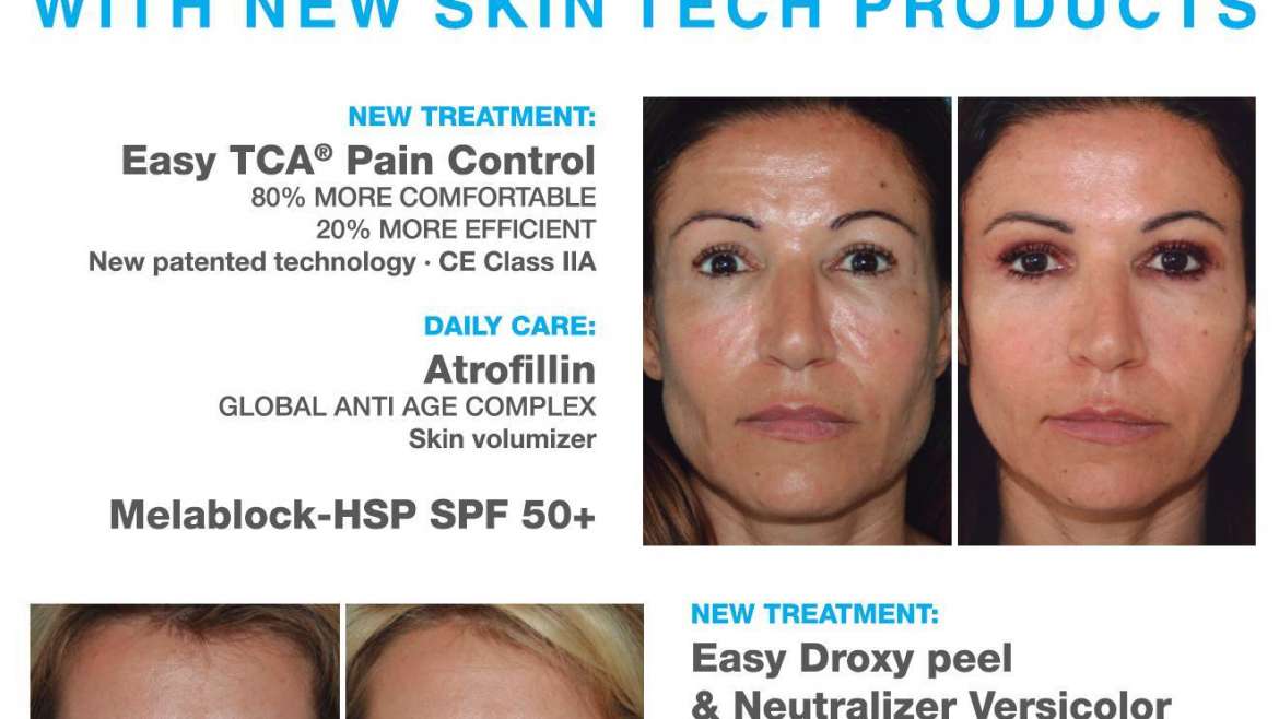 Best Results από τη Skin Tech!